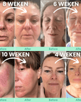 6 - stappen menopauze skincare routine voor 40+ en 50+ - VelveuxNL - 8720618457936 - Vegan en Natuurlijke skincare routine's