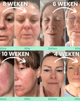 6 - stappen menopauze skincare routine voor 40+ en 50+ - VelveuxNL - 8720618457936 - Vegan en Natuurlijke skincare routine's
