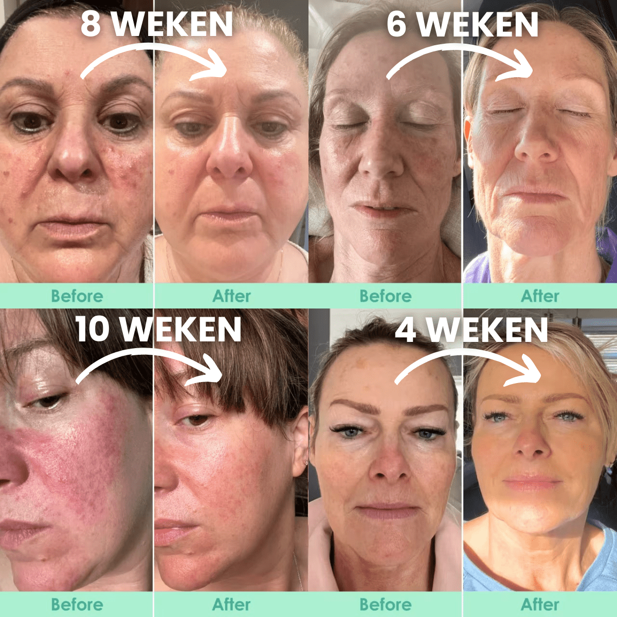 6 - stappen menopauze skincare routine voor 40+ en 50+ - VelveuxNL - 8720618457936 - Vegan en Natuurlijke skincare routine's