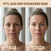 Voor en na twee weken: zichtbaar strakkere en gladdere huid