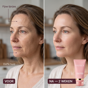 Voor en na - fijne lijntjes en doffe huid na 2 weken